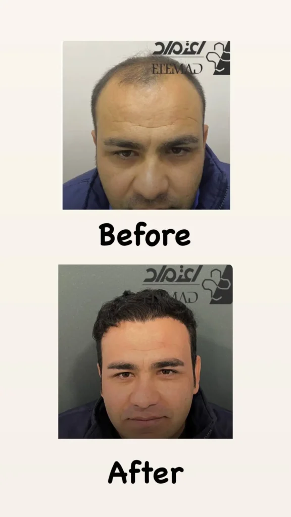 نمونه کار کاشت کلینیک اعتماد
