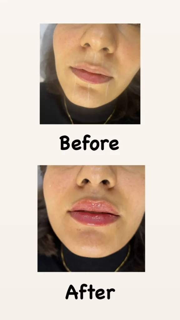 نمونه کار تزریقات کلینیک اعتماد