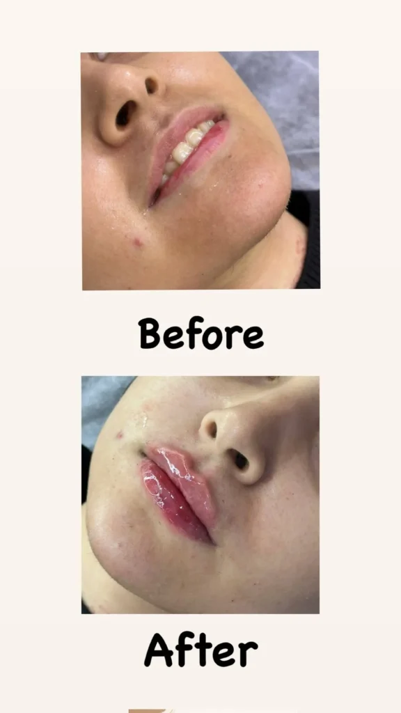 نمونه کار تزریقات کلینیک اعتماد