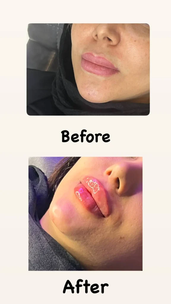 نمونه کار تزریقات کلینیک اعتماد