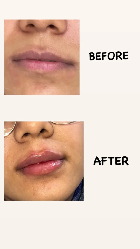 نمونه کار تزریقات کلینیک اعتماد